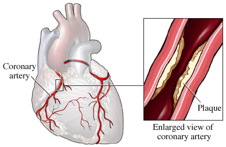 CHD.N